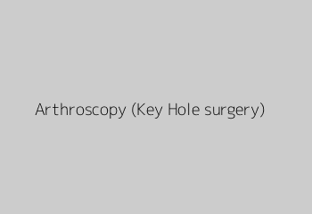 Arthroscopy (Key Hole surgery)
