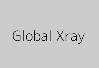 Global Xray