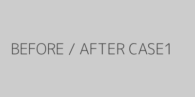 CASE1ビフォーアフター症例