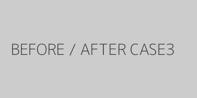 CASE3ビフォーアフター症例