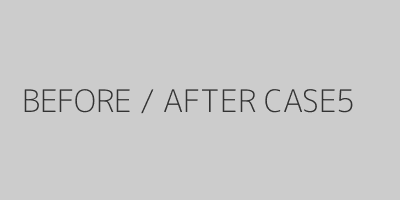 CASE5ビフォーアフター症例