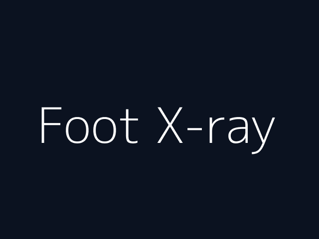 Foot X-ray