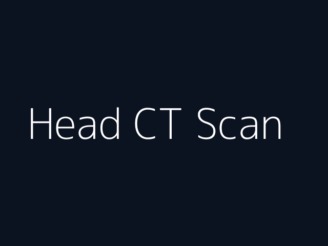 Head CT Scan