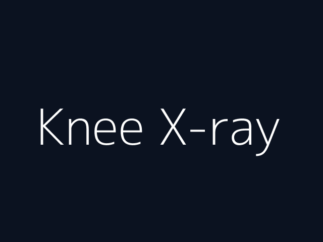 Knee X-ray